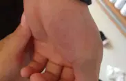 治疗图